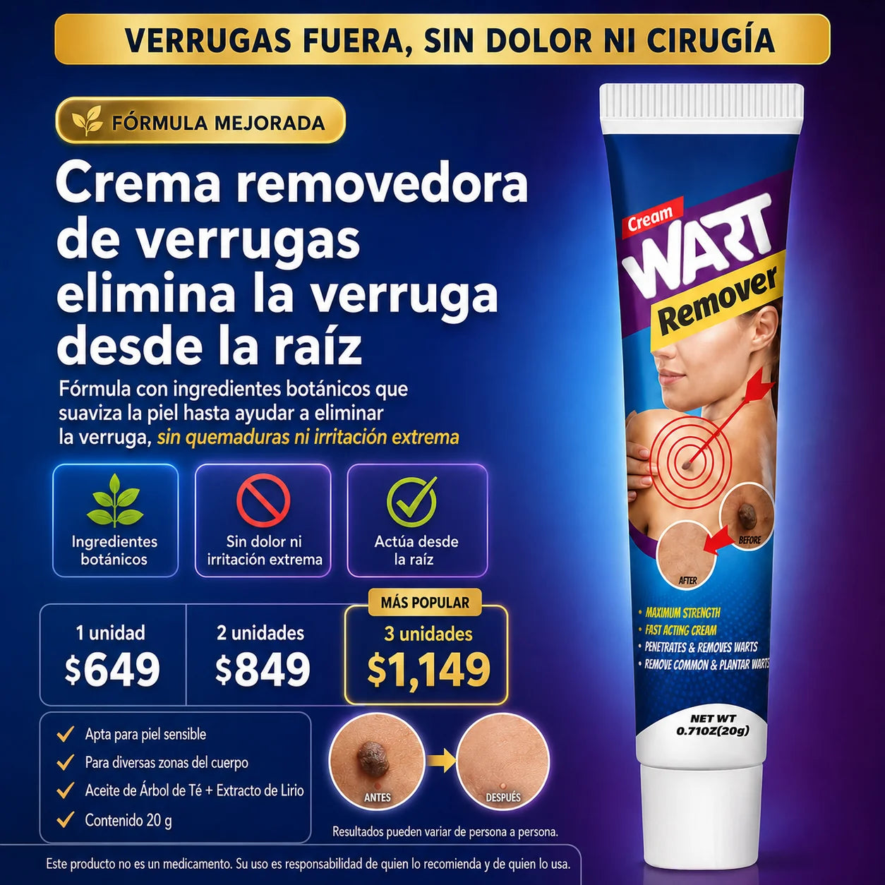 Crema removedora de verrugas